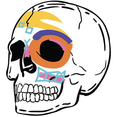 A illustration of a 3D-printed model showing the bone grafts that Dr. Lin used to reconstruct a patient’s skull. 