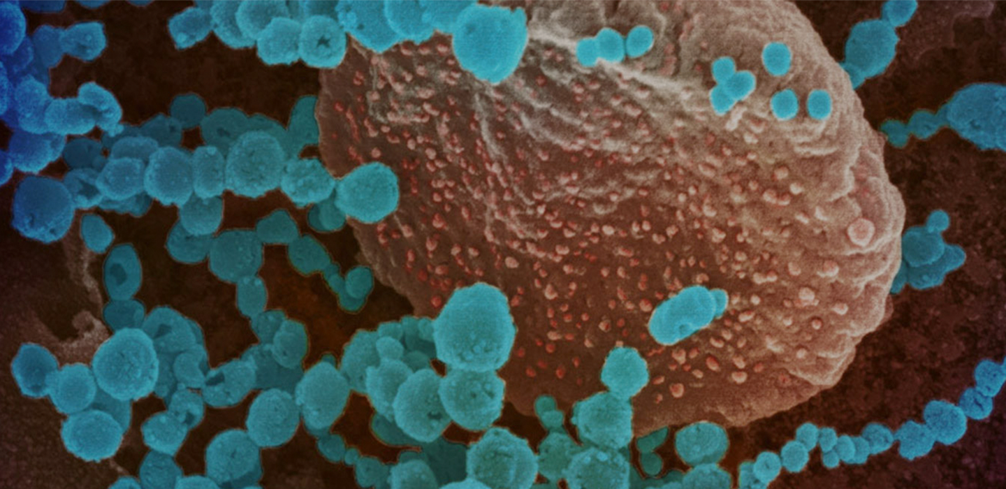 Coronavirus