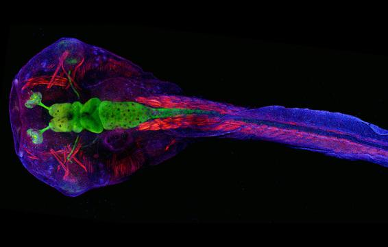 How Frog Brains Are Helping Understand Autism