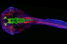 How Frog Brains Are Helping Understand Autism